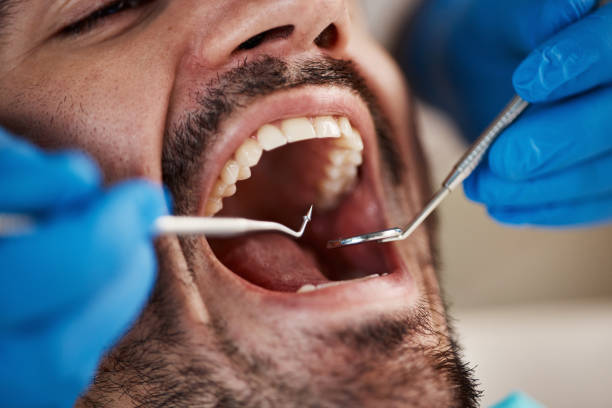 Best Emergency Dental Care for Broken or Chipped Teeth in Hilbert, WI