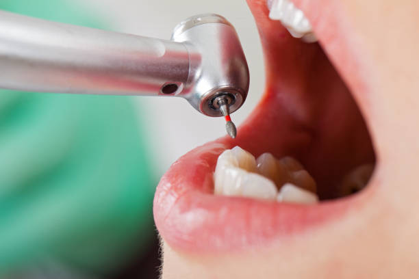 Best Pediatric Emergency Dentist in Hilbert, WI